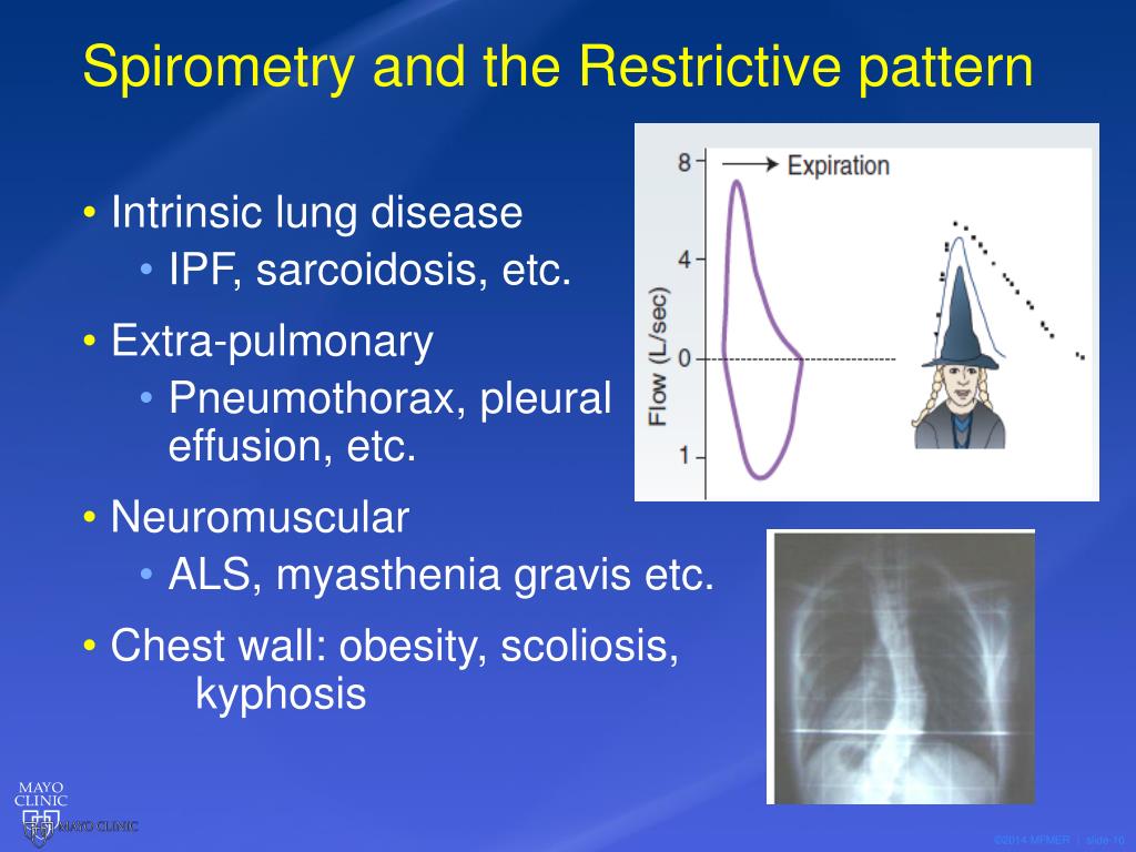PPT The Evaluation of Chronic Cough PowerPoint Presentation, free