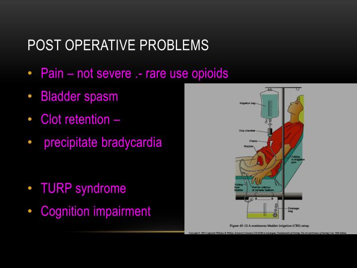 PPT AnAesthetic management of TURP PowerPoint Presentation ID1874585
