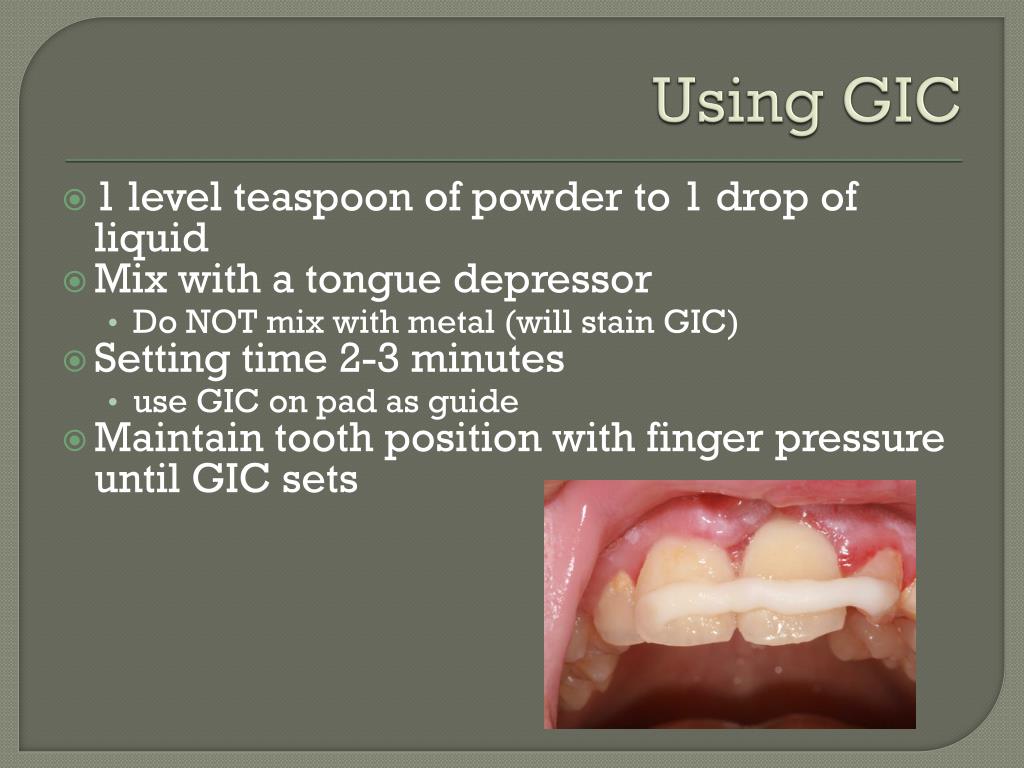 PPT Dental Trauma PowerPoint Presentation, free download ID1880328