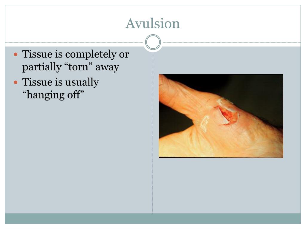 PPT Injury Evaluation Terminology PowerPoint Presentation, free