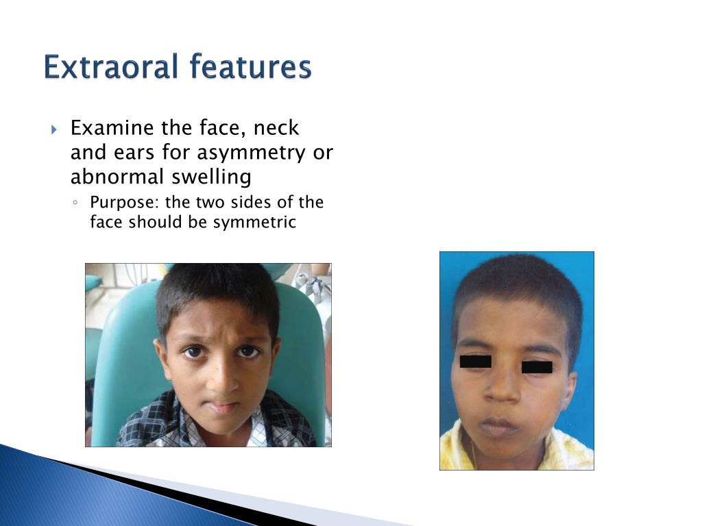 PPT EXTRA AND INTRA ORAL EXAMINATION PowerPoint Presentation, free