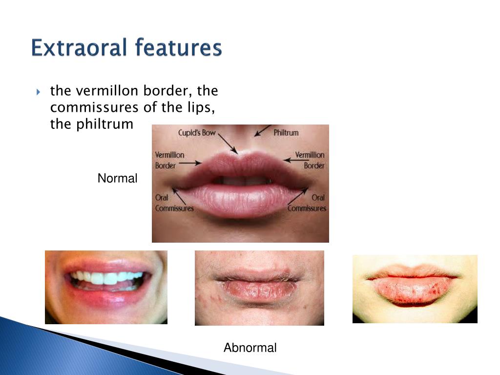 PPT EXTRA AND INTRA ORAL EXAMINATION PowerPoint Presentation, free download ID1892499