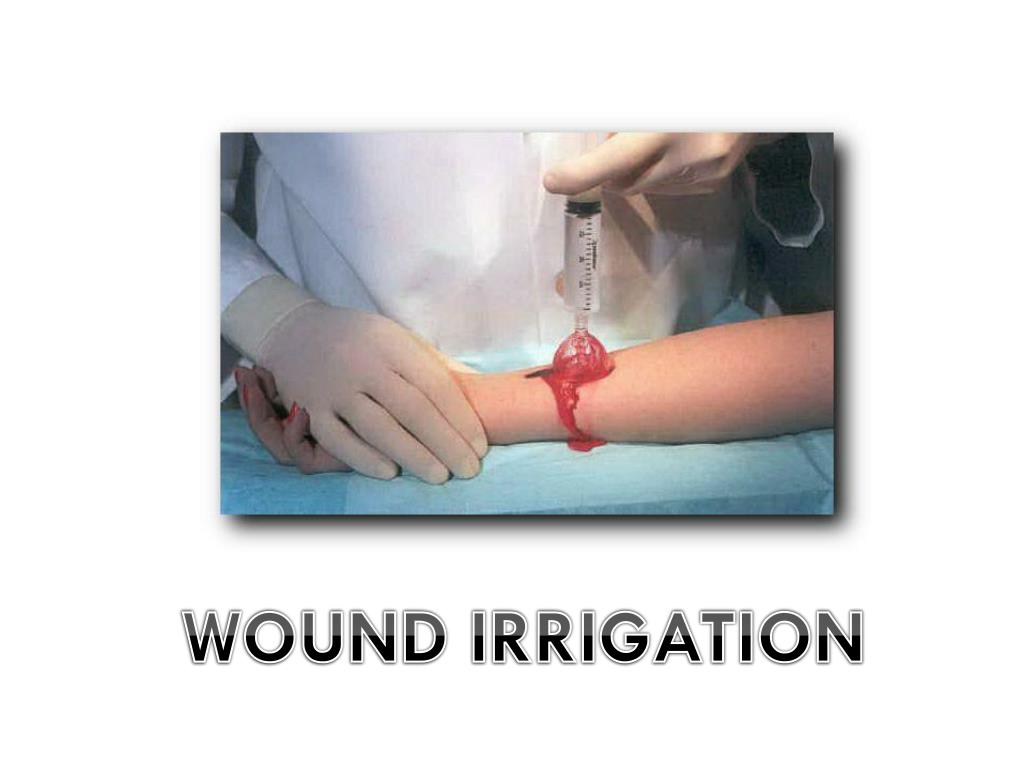 PPT CHRONIC WOUND TREATMENT PowerPoint Presentation, free download