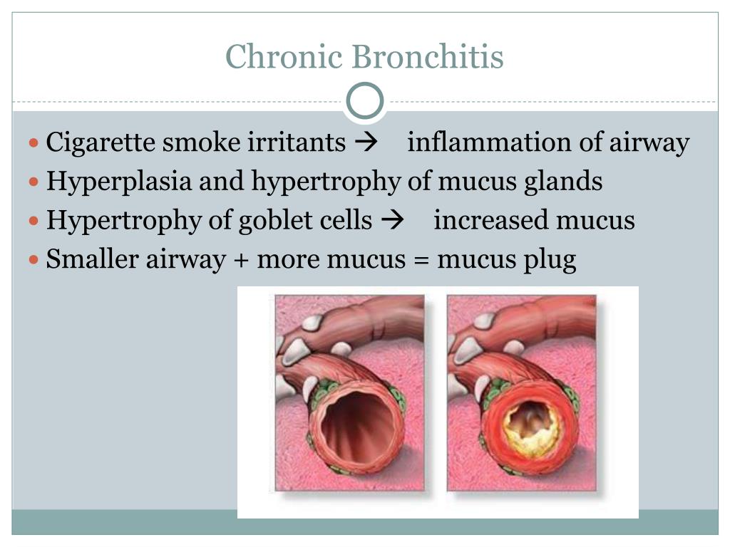 PPT Chronic Obstructive Pulmonary Disease (COPD) PowerPoint