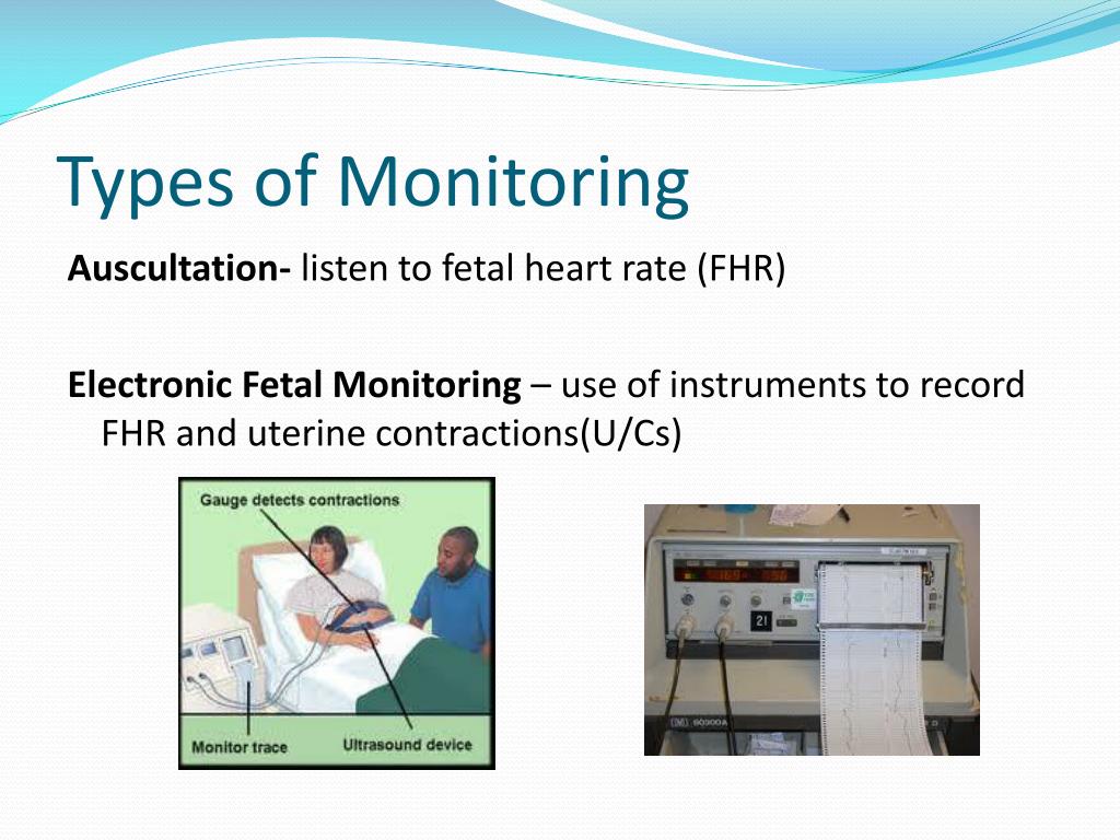 PPT Fetal Monitoring Basics Expanded PowerPoint Presentation, free
