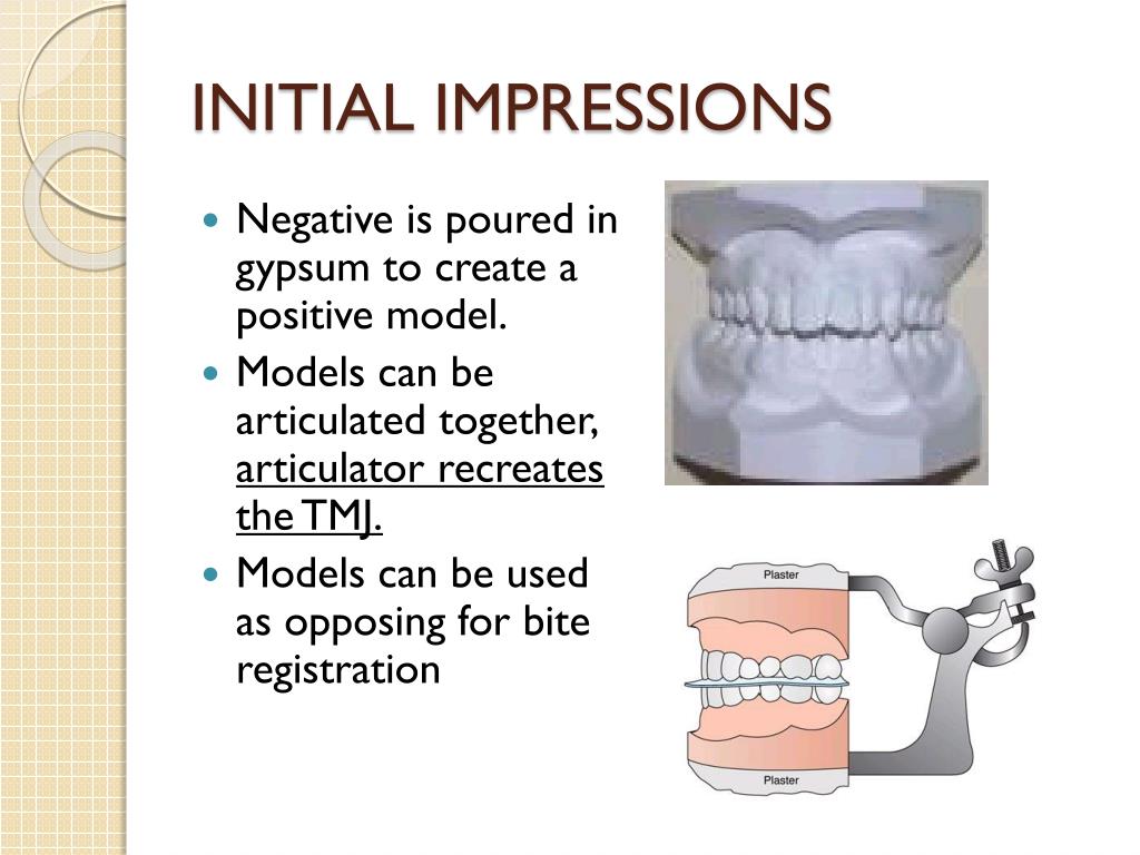 PPT Impression Material PowerPoint Presentation, free download ID