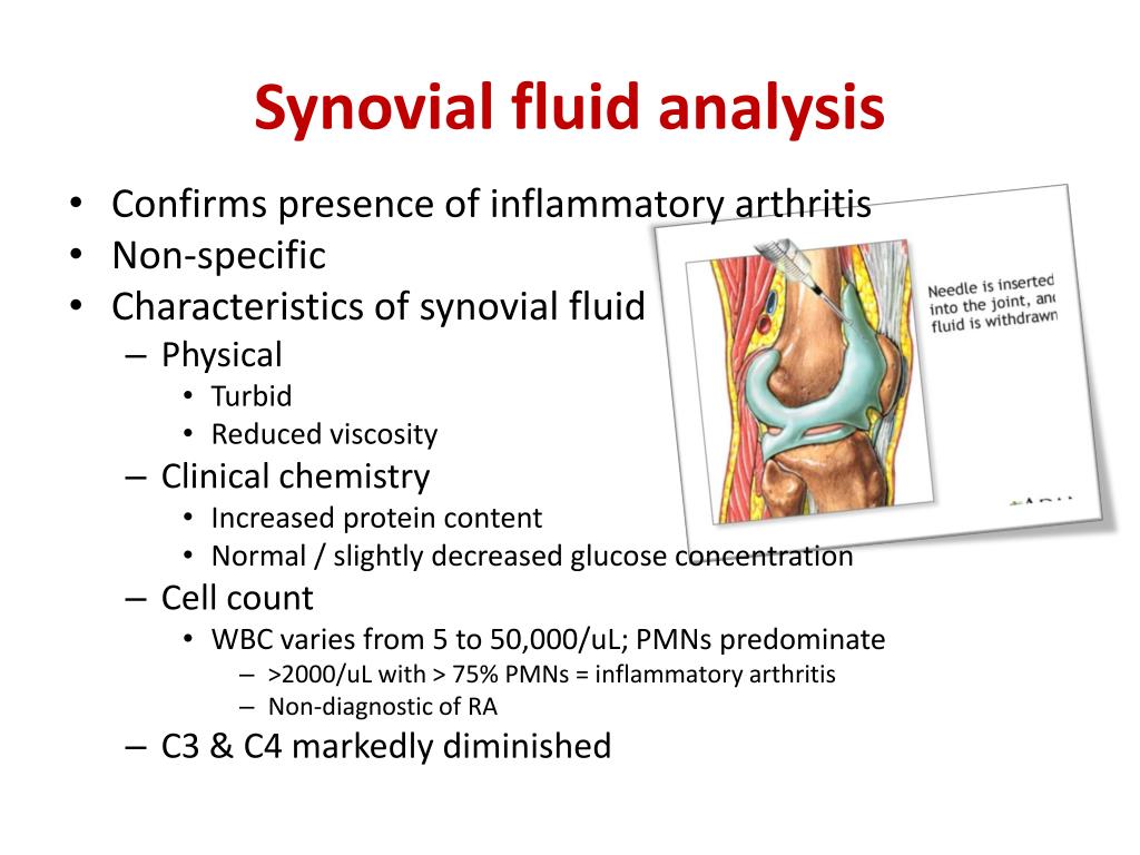 PPT Tests for Rheumatoid Arthritis PowerPoint Presentation, free