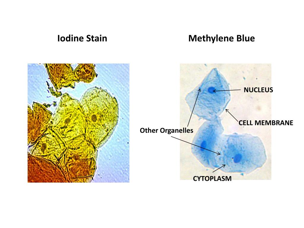 PPT Iodine Stain PowerPoint Presentation, free download ID1922886