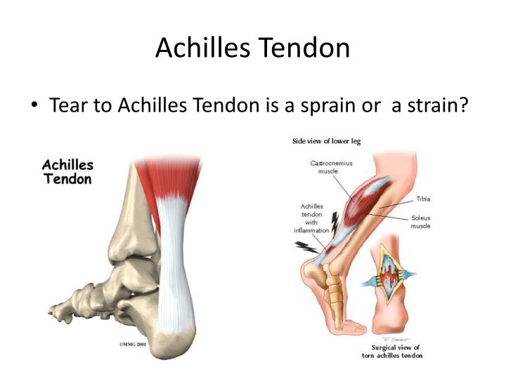 PPT Lateral Ankle Ligaments PowerPoint Presentation ID