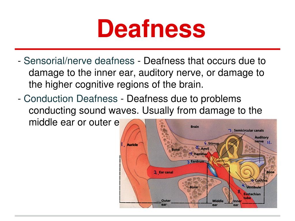 PPT Hearing PowerPoint Presentation, free download ID1926555