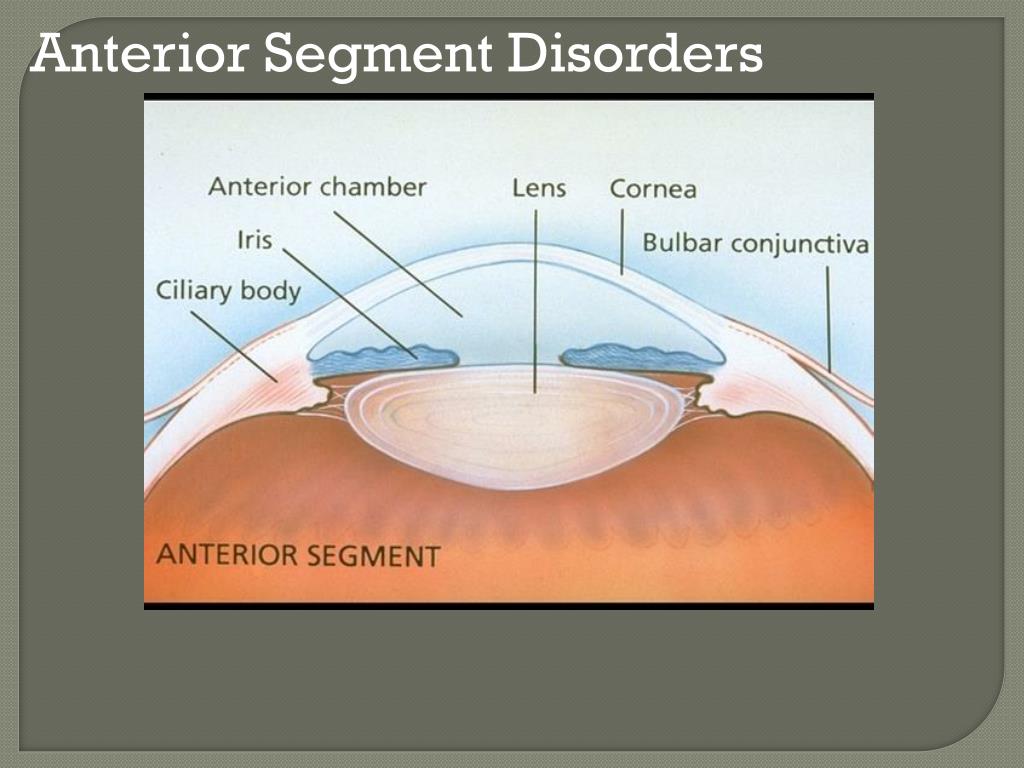 PPT Common Eye Problems in Primary Care PowerPoint Presentation, free