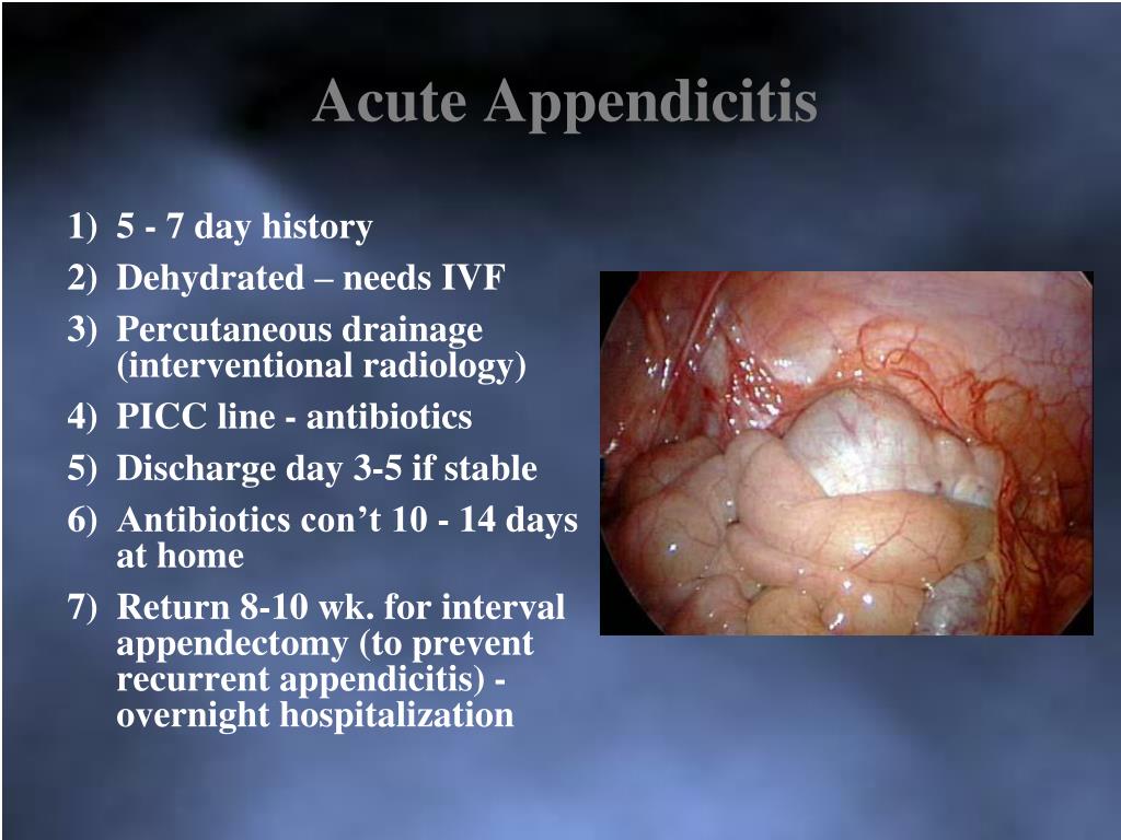 PPT Current Management of Children with Appendicitis PowerPoint