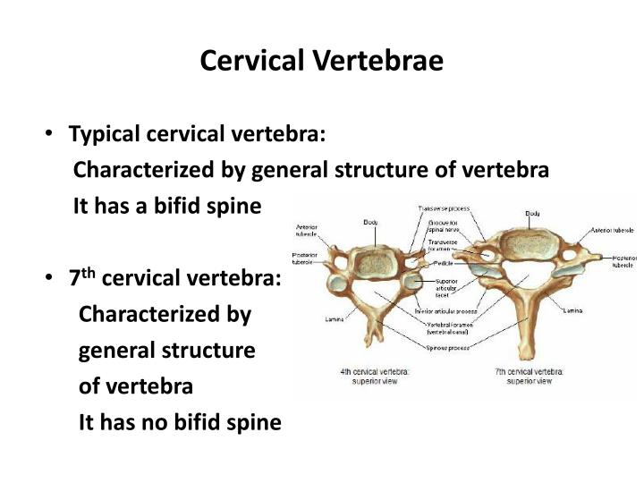 PPT Vertebral Column PowerPoint Presentation ID1939552