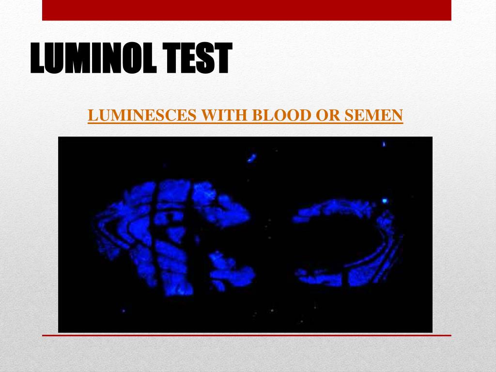 PPT Chapter 11; Blood PowerPoint Presentation, free download ID1940553