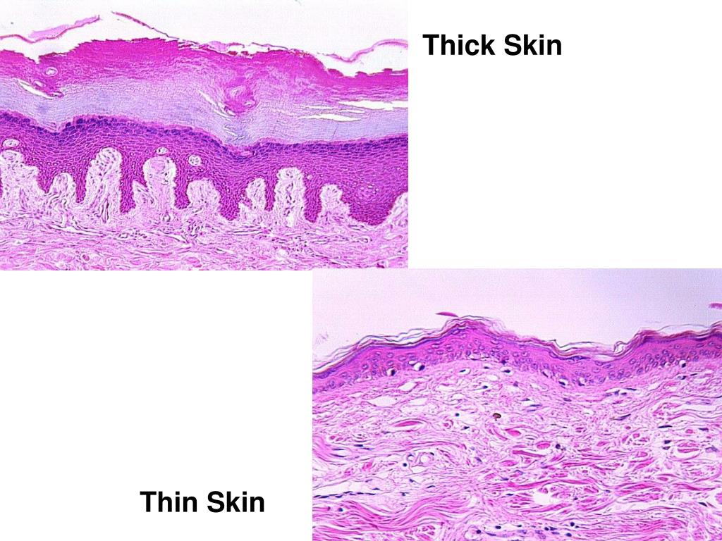 PPT Chapter 5 Skin and the Integumentary System PowerPoint