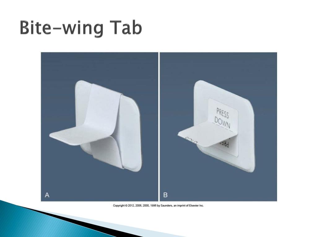 PPT The Bitewing Technique PowerPoint Presentation, free download