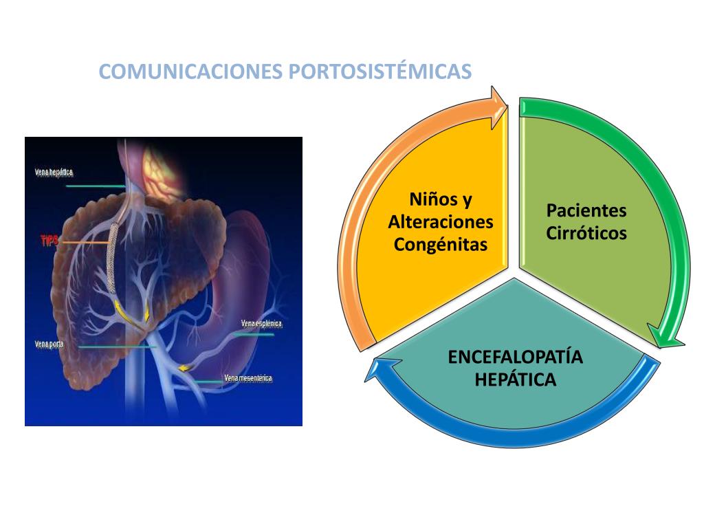 PPT ENCEFALOPATÍA HEPÁTICA PowerPoint Presentation, free download