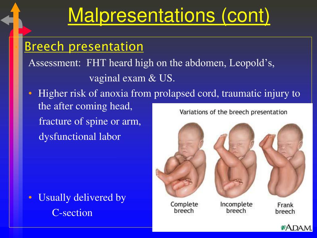 PPT Chapter 22Processes & Stages of Labor and Birth PowerPoint Presentation ID1982713