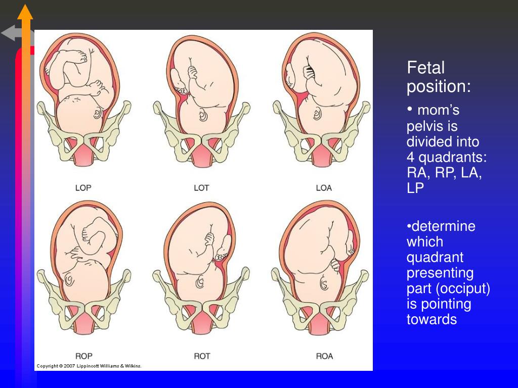 PPT Chapter 22Processes & Stages of Labor and Birth PowerPoint