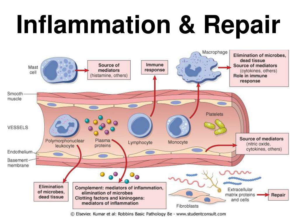 PPT Inflammation & Repair PowerPoint Presentation, free download ID