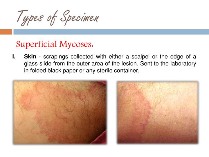 PPT KOH SMEAR PowerPoint Presentation ID2000540