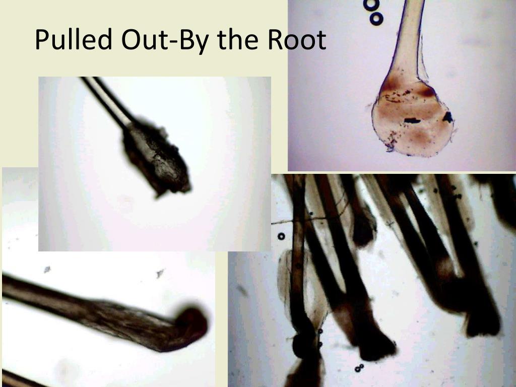 PPT Forensic Analysis of Hair PowerPoint Presentation, free download