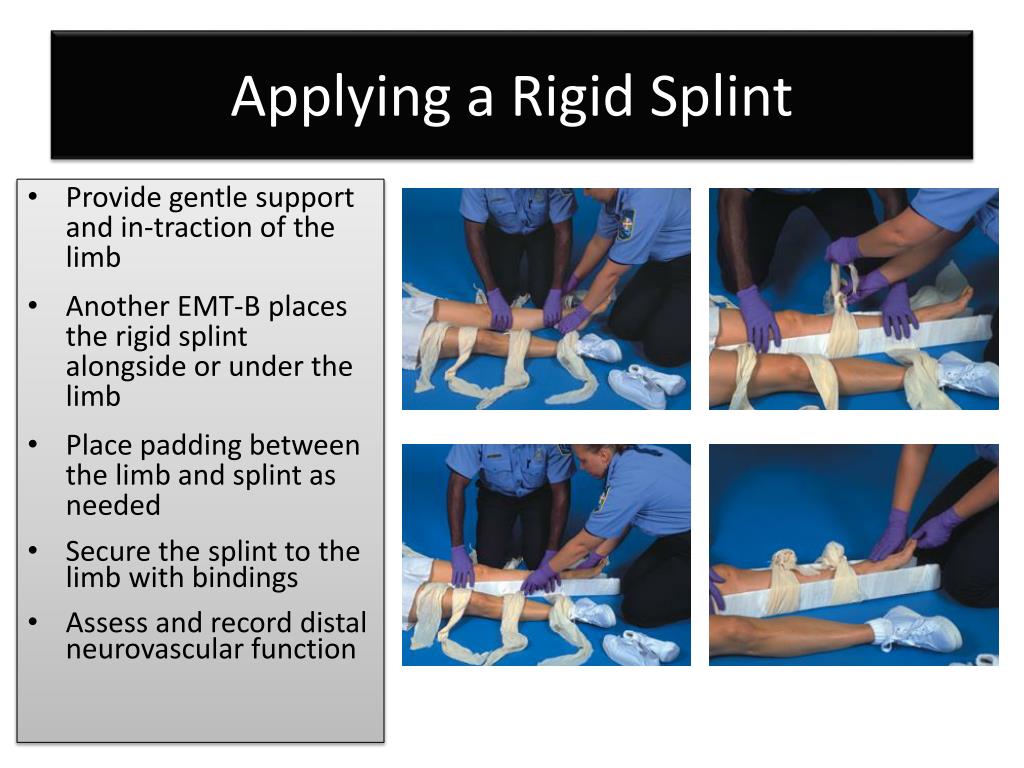 PPT Musculoskeletal Care PowerPoint Presentation, free download ID