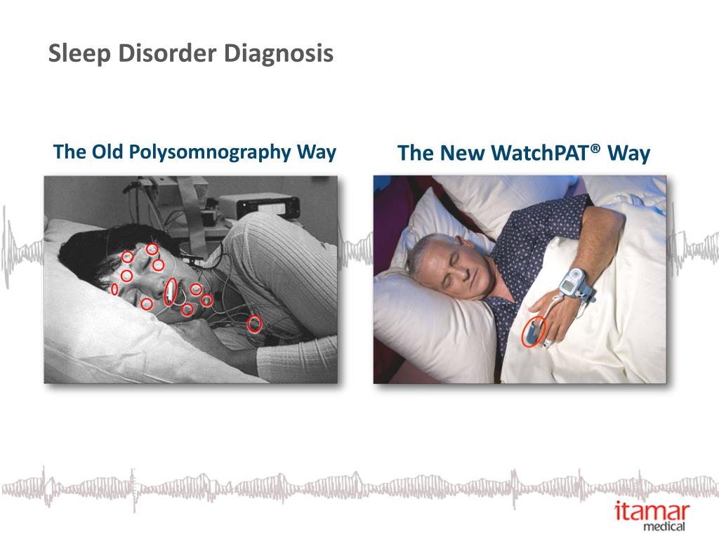PPT Itamar Medical Ltd. Transferring Great Science into Patient Care