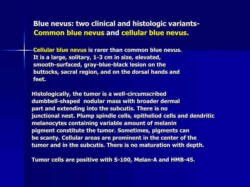 PPT Cellular blue nevus PowerPoint Presentation, free download ID2054532