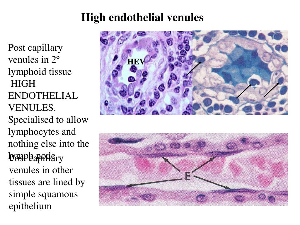 PPT Inflammation PowerPoint Presentation, free download ID2058327