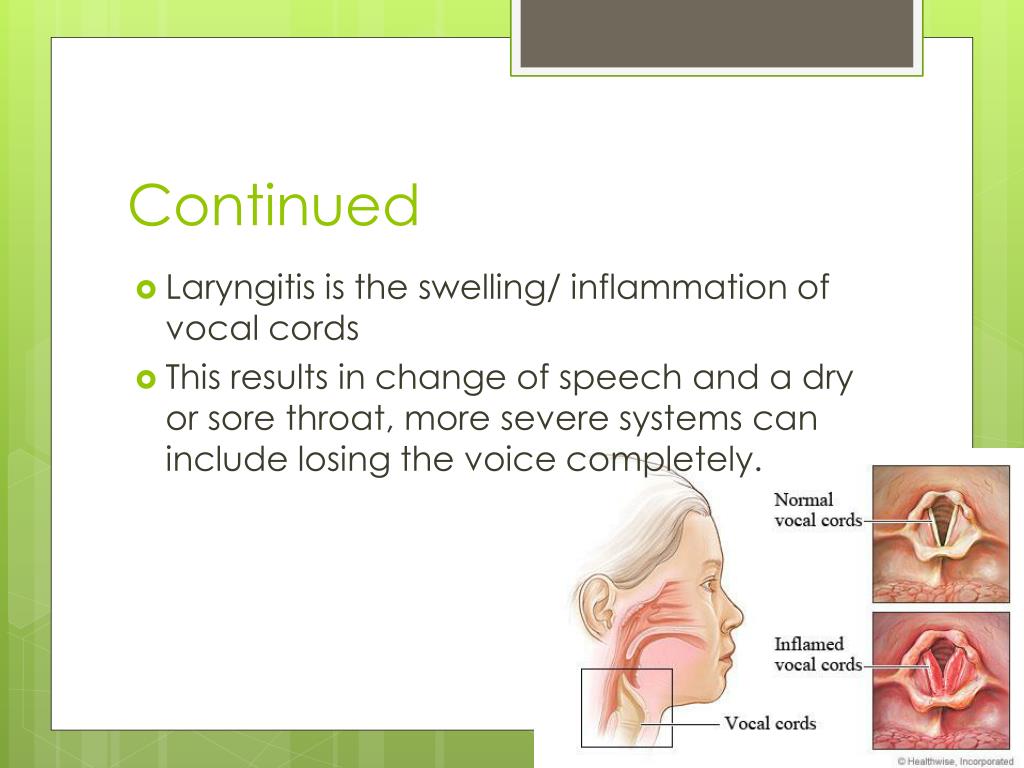 PPT Larynx PowerPoint Presentation, free download ID2062891
