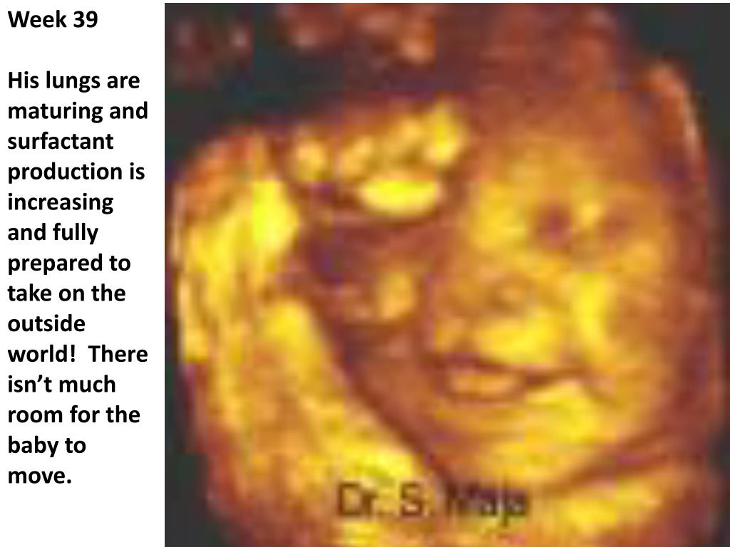 PPT I praise you because I am fearfully and wonderfully made; your