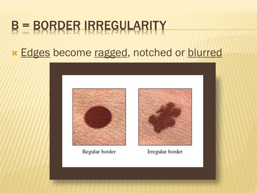 PPT Injuries and First Aid PowerPoint Presentation, free download