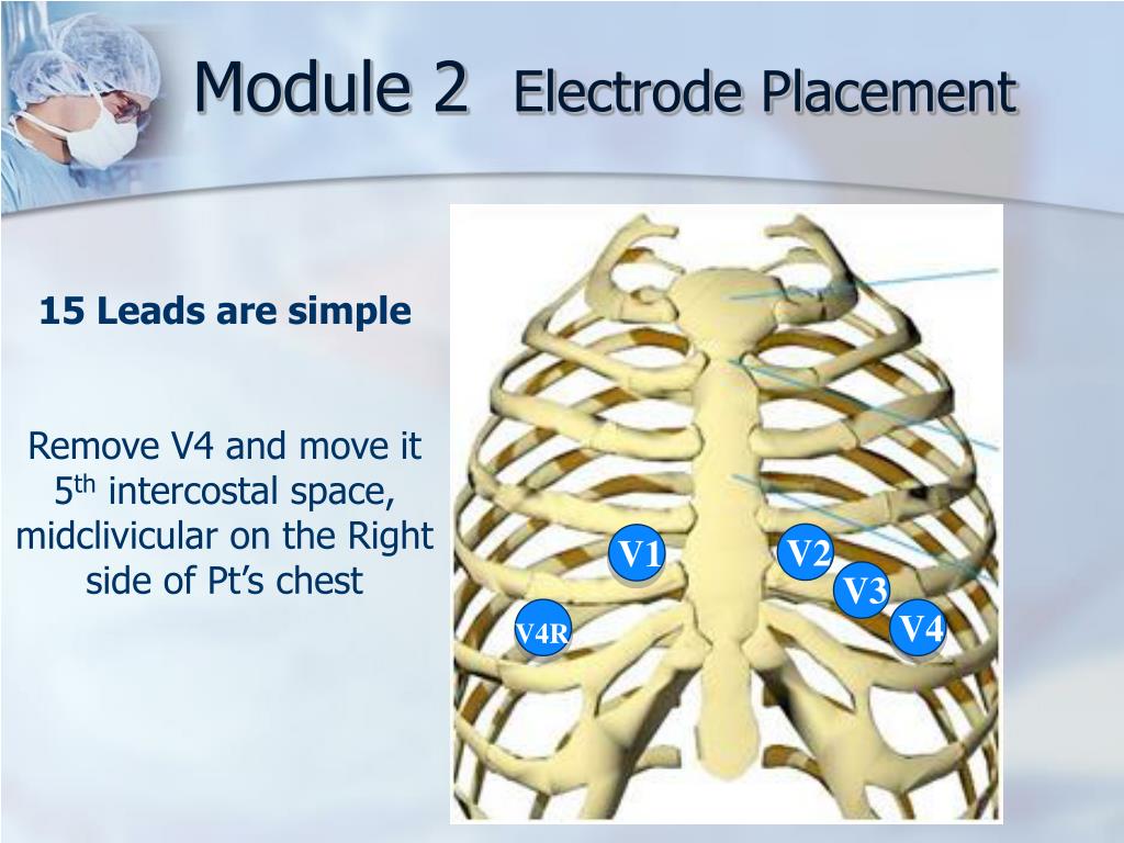 PPT 12 and 15 Lead Acquisition PowerPoint Presentation, free download ID2074720