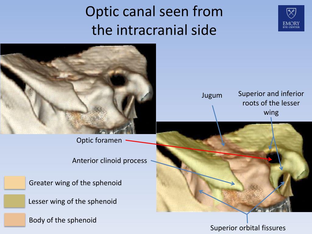PPT Osseous Anatomy of the Optic C anals PowerPoint Presentation