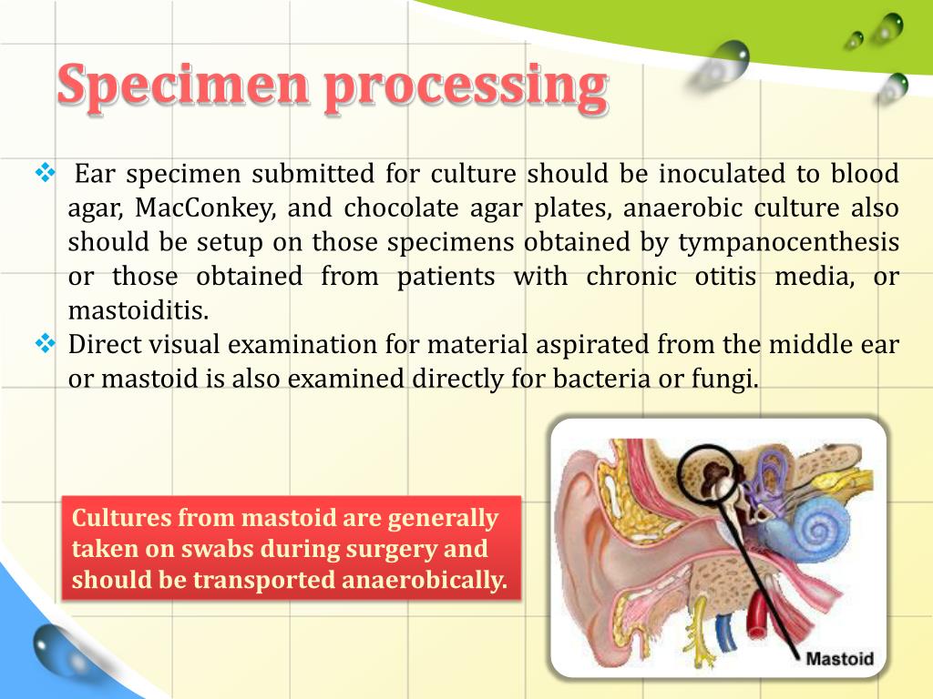 PPT Ear Culture PowerPoint Presentation, free download ID2082085