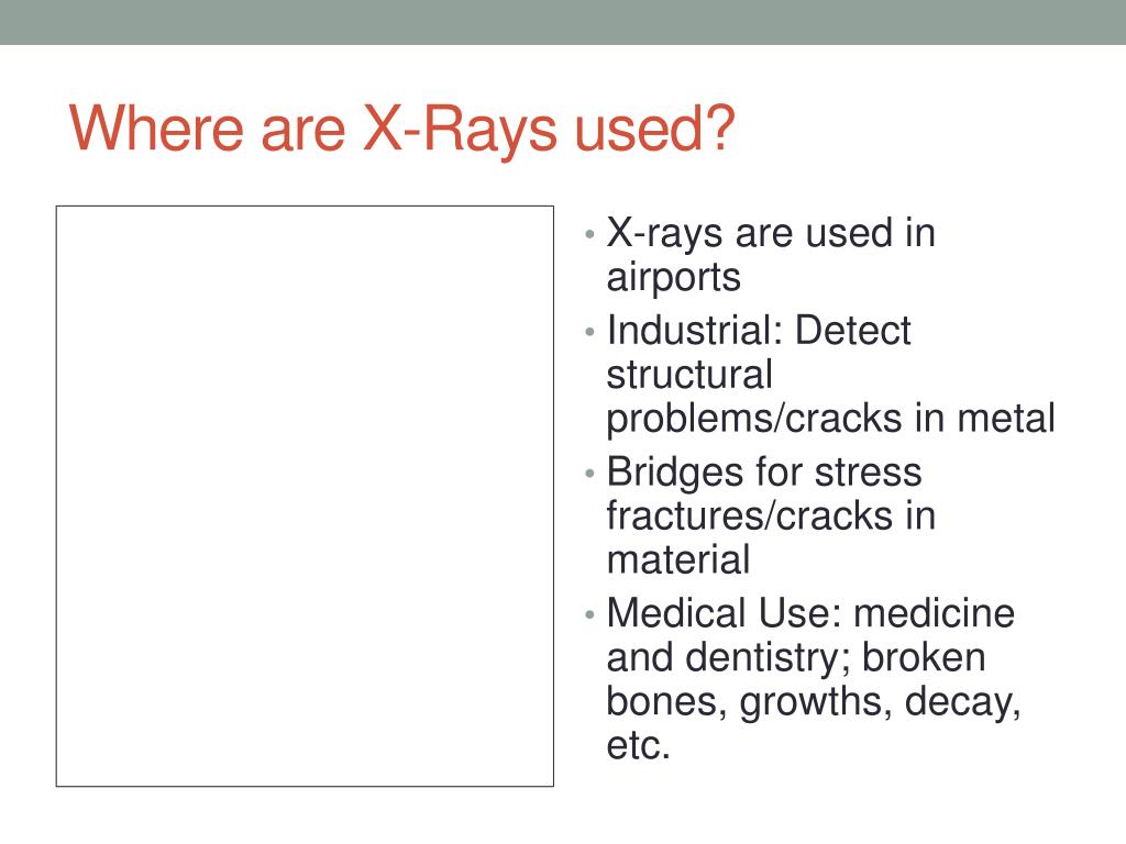 PPT Common Uses of XRays PowerPoint Presentation, free download ID