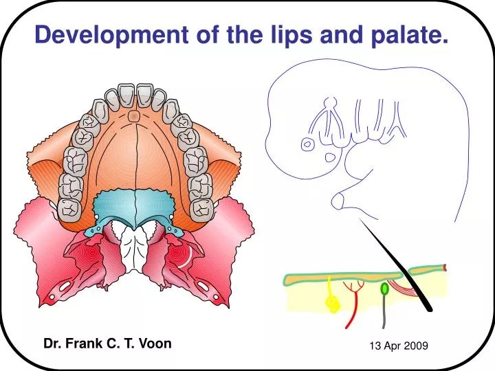 PPT Development of the lips and palate. PowerPoint Presentation, free