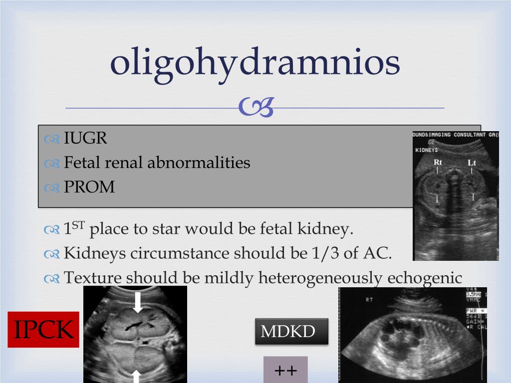 PPT Biophysical profile PowerPoint Presentation, free download ID2108225