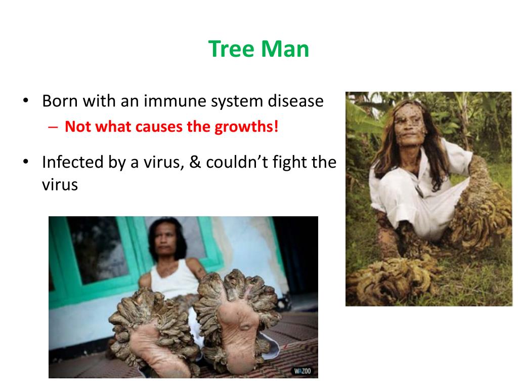 PPT Tree Man PowerPoint Presentation, free download ID2110964