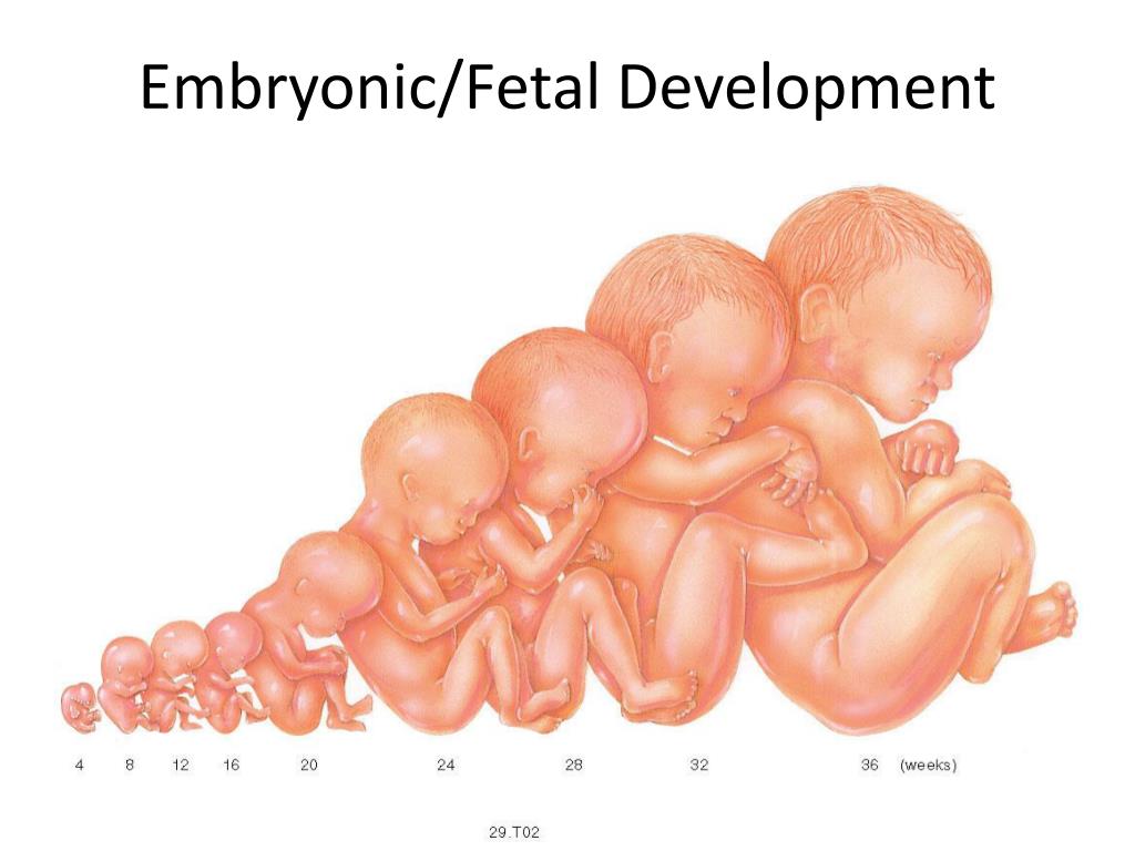 PPT Disease Disorders and Human Development PowerPoint Presentation
