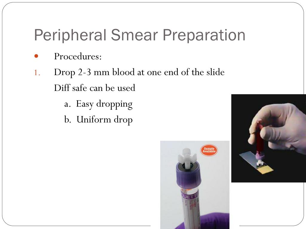 PPT Examination of Peripheral Blood Smear PowerPoint Presentation