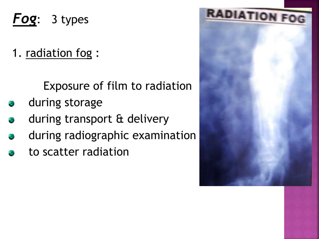 PPT RADIOGRAPHIC PROCESSING PowerPoint Presentation, free download