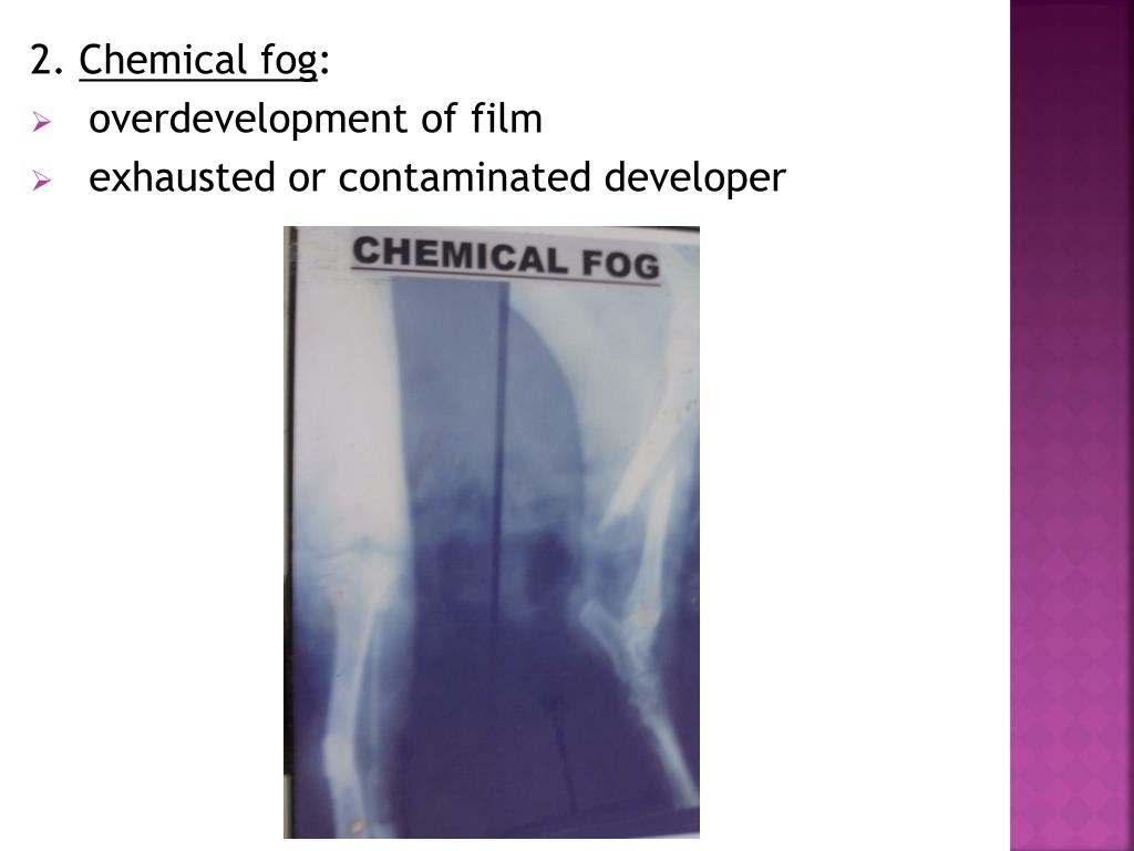 PPT RADIOGRAPHIC PROCESSING PowerPoint Presentation, free download