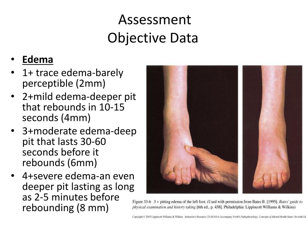 Best Cardiovascular Endurance Definition Gcse Pe Aqa With Best Trainer