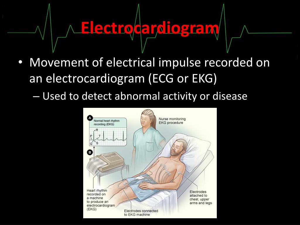 PPT Circulatory System DHO Chapter 78 PowerPoint Presentation, free