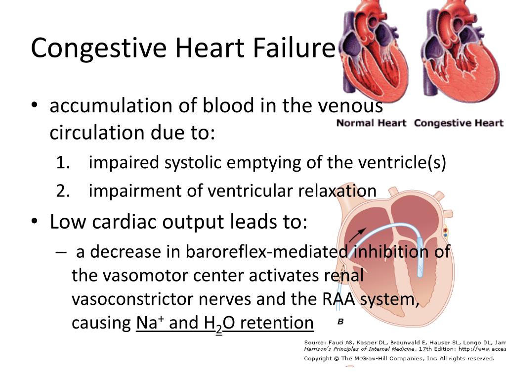 PPT Cardinal Manifestation of Disease EDEMA PowerPoint Presentation