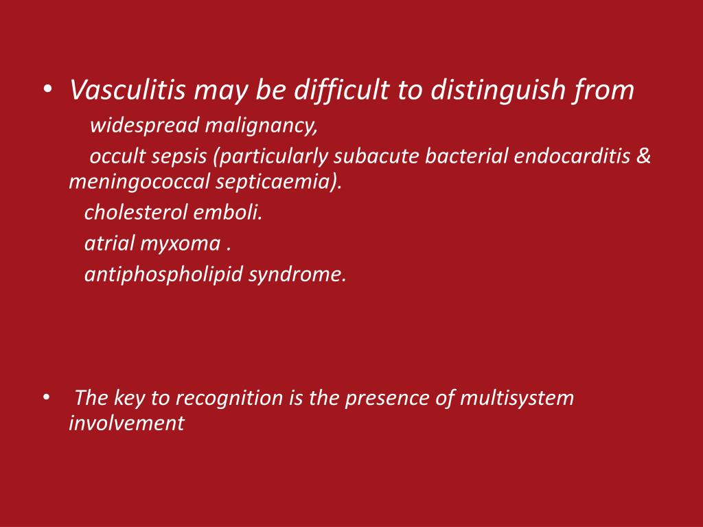PPT Vasculitis PowerPoint Presentation, free download ID2136811