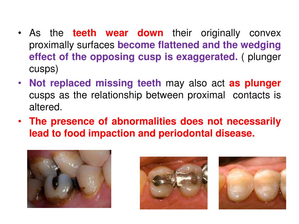 PPT Plaque control for the prevention of oral diseases PowerPoint