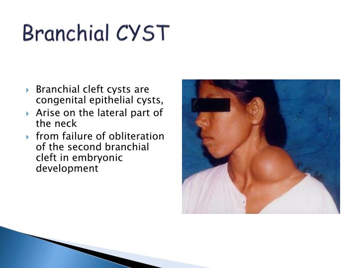 PPT Neck Swelling Differential Diagnosis PowerPoint PPT Neck Swelling Differential Diagnosis PowerPoint